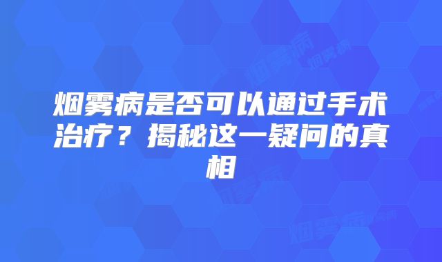 烟雾病是否可以通过手术治疗？揭秘这一疑问的真相