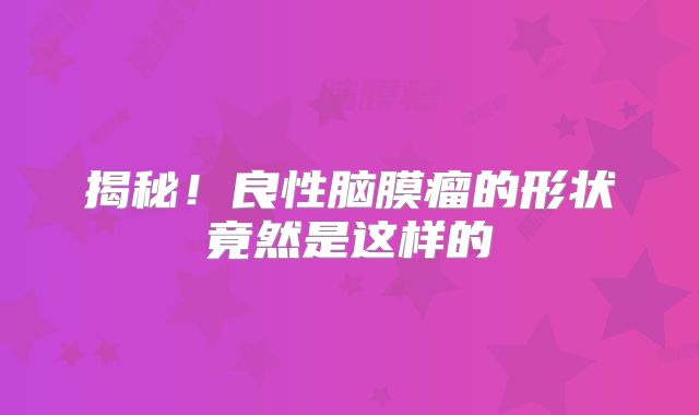 揭秘！良性脑膜瘤的形状竟然是这样的