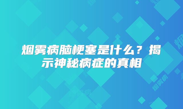 烟雾病脑梗塞是什么？揭示神秘病症的真相