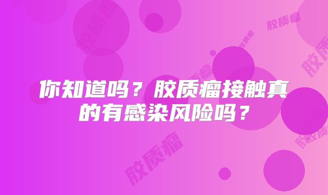 你知道吗？胶质瘤接触真的有感染风险吗？