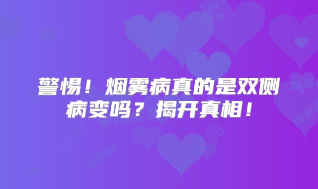 警惕！烟雾病真的是双侧病变吗？揭开真相！
