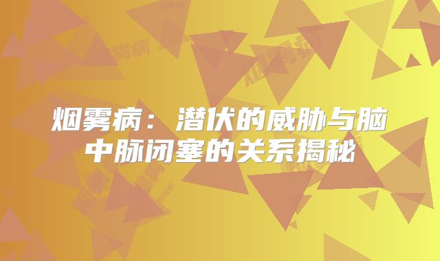 烟雾病：潜伏的威胁与脑中脉闭塞的关系揭秘