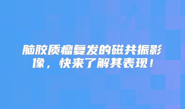 脑胶质瘤复发的磁共振影像，快来了解其表现！