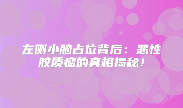 左侧小脑占位背后：恶性胶质瘤的真相揭秘！