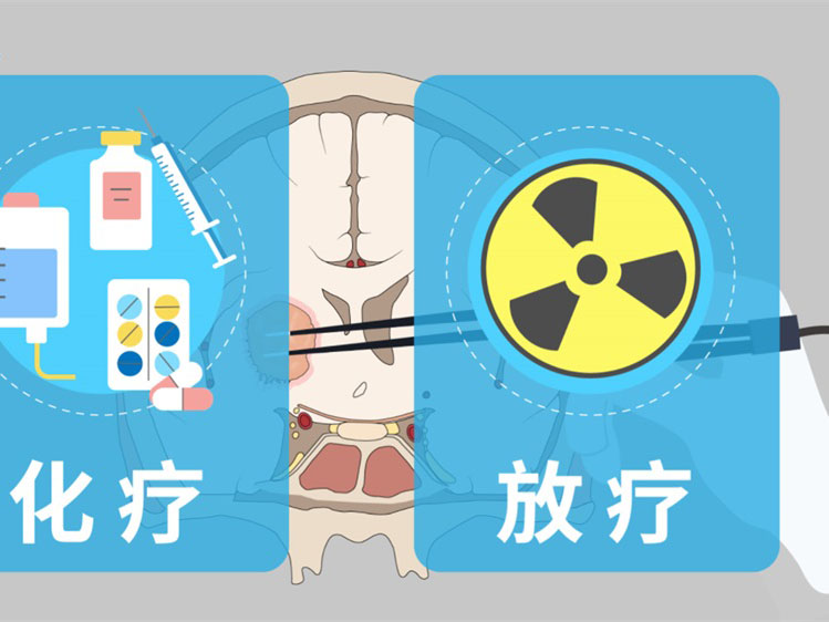 烟雾病搭桥术后复查CTA：最佳时间揭秘，助您重拾健康视野