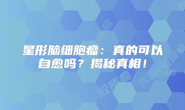 星形脑细胞瘤：真的可以自愈吗？揭秘真相！