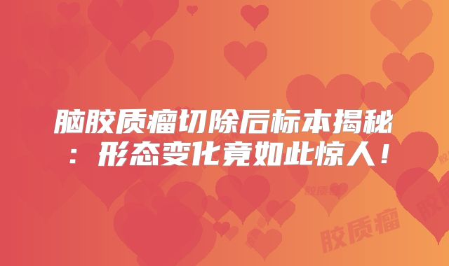 脑胶质瘤切除后标本揭秘：形态变化竟如此惊人！