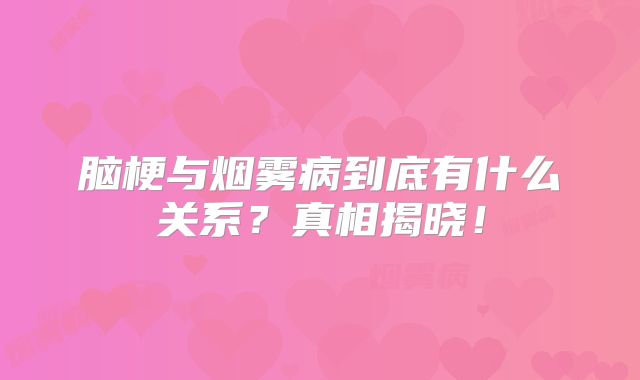 脑梗与烟雾病到底有什么关系？真相揭晓！