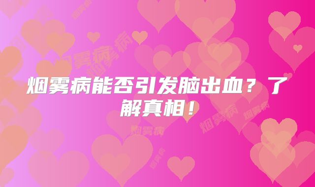 烟雾病能否引发脑出血？了解真相！