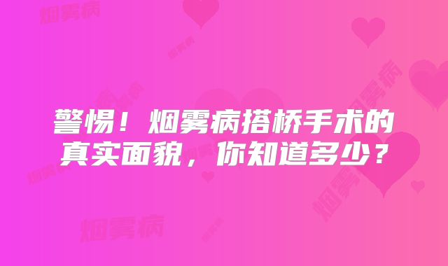 警惕！烟雾病搭桥手术的真实面貌，你知道多少？