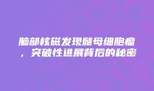 脑部核磁发现髓母细胞瘤，突破性进展背后的秘密