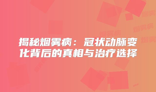 揭秘烟雾病：冠状动脉变化背后的真相与治疗选择