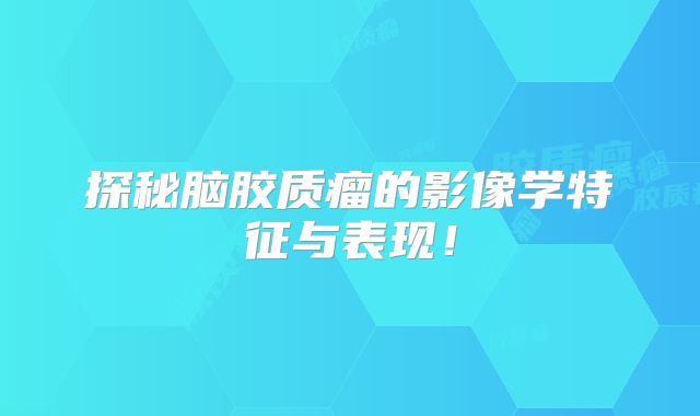 探秘脑胶质瘤的影像学特征与表现！