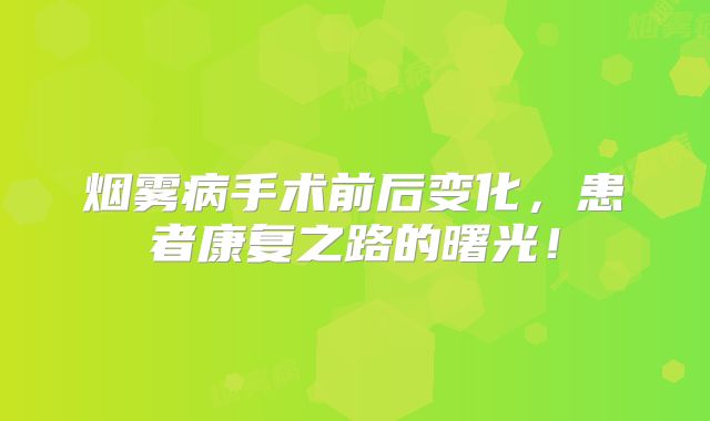 烟雾病手术前后变化，患者康复之路的曙光！