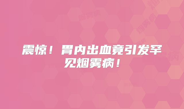 震惊！胃内出血竟引发罕见烟雾病！