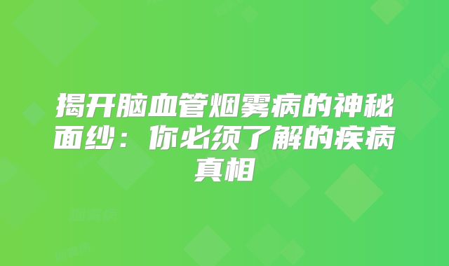 揭开脑血管烟雾病的神秘面纱：你必须了解的疾病真相