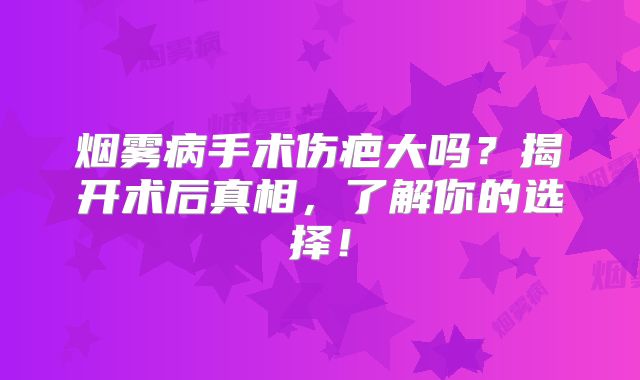 烟雾病手术伤疤大吗？揭开术后真相，了解你的选择！