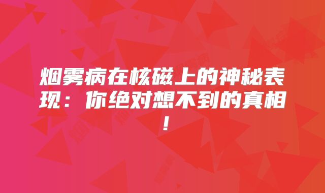 烟雾病在核磁上的神秘表现：你绝对想不到的真相！