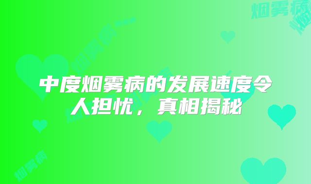 中度烟雾病的发展速度令人担忧，真相揭秘