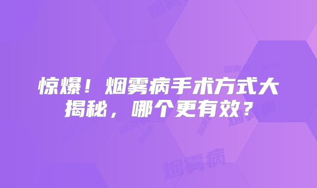 惊爆！烟雾病手术方式大揭秘，哪个更有效？