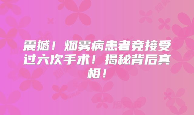 震撼！烟雾病患者竟接受过六次手术！揭秘背后真相！
