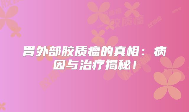 胃外部胶质瘤的真相：病因与治疗揭秘！