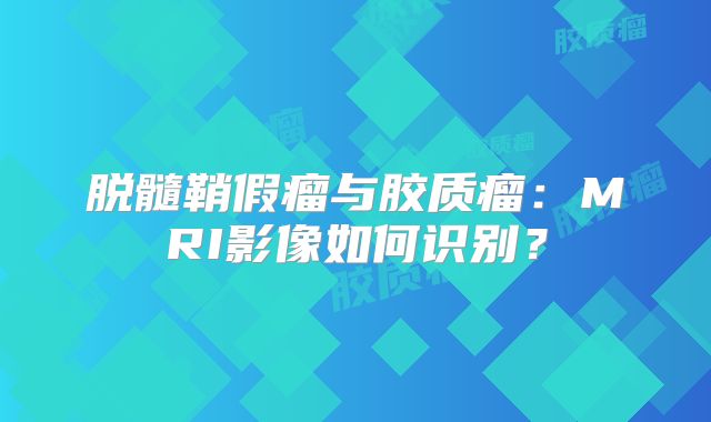 脱髓鞘假瘤与胶质瘤：MRI影像如何识别？