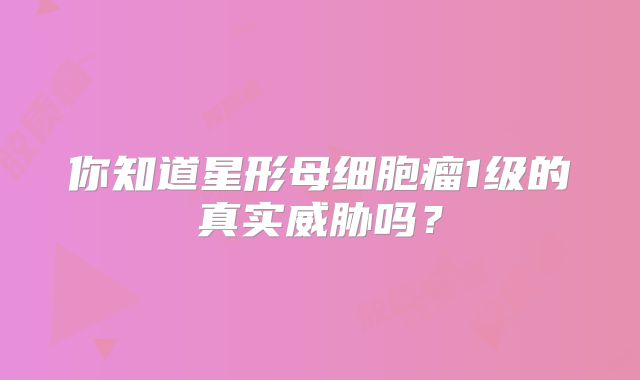 你知道星形母细胞瘤1级的真实威胁吗？