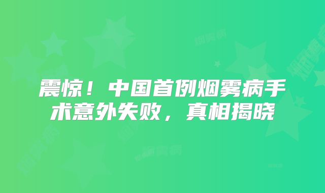 震惊！中国首例烟雾病手术意外失败，真相揭晓