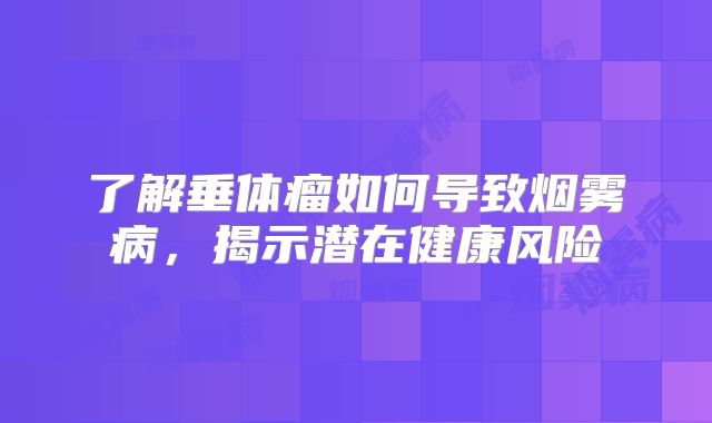 了解垂体瘤如何导致烟雾病，揭示潜在健康风险