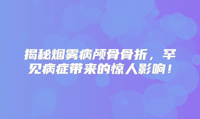揭秘烟雾病颅骨骨折，罕见病症带来的惊人影响！