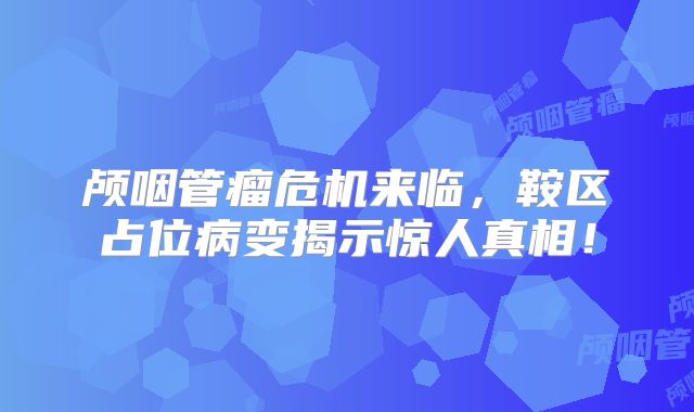 颅咽管瘤危机来临，鞍区占位病变揭示惊人真相！
