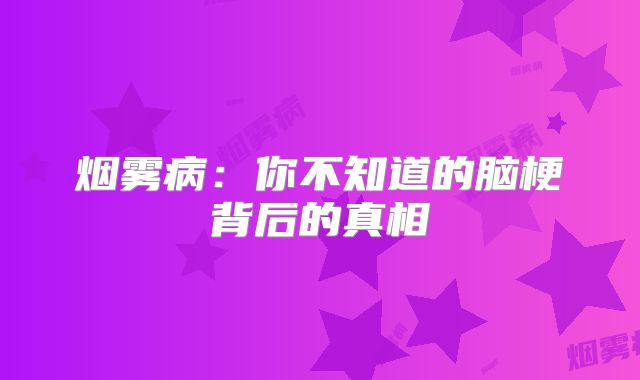 烟雾病：你不知道的脑梗背后的真相