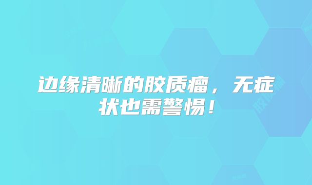 边缘清晰的胶质瘤，无症状也需警惕！
