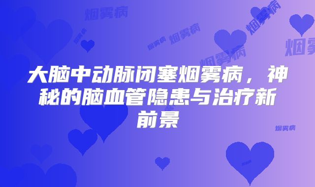 大脑中动脉闭塞烟雾病，神秘的脑血管隐患与治疗新前景