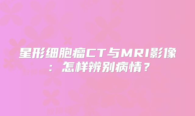 星形细胞瘤CT与MRI影像：怎样辨别病情？