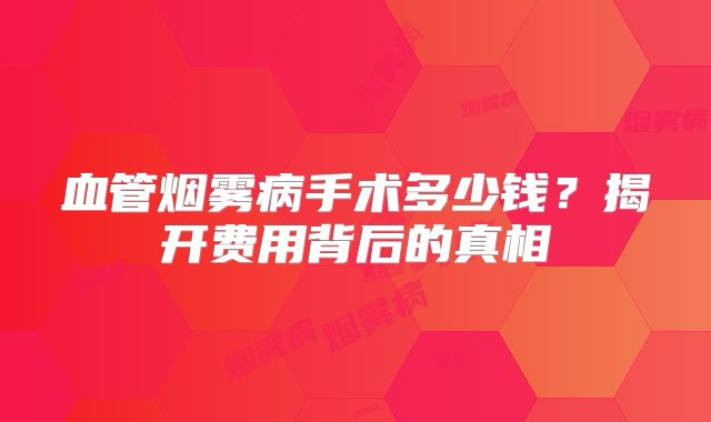 血管烟雾病手术多少钱？揭开费用背后的真相