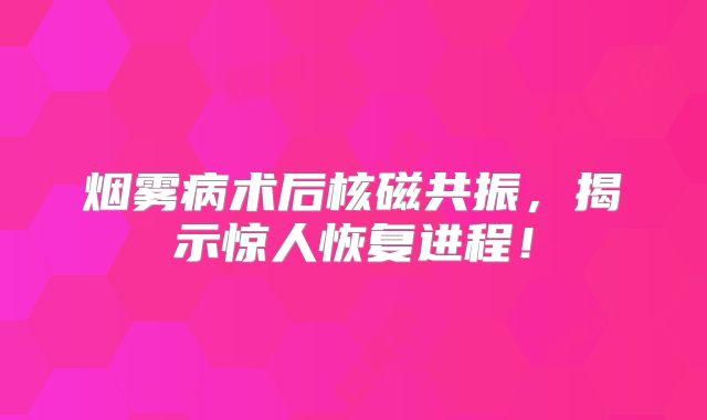 烟雾病术后核磁共振，揭示惊人恢复进程！