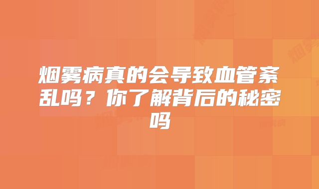 烟雾病真的会导致血管紊乱吗？你了解背后的秘密吗