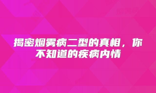 揭密烟雾病二型的真相，你不知道的疾病内情