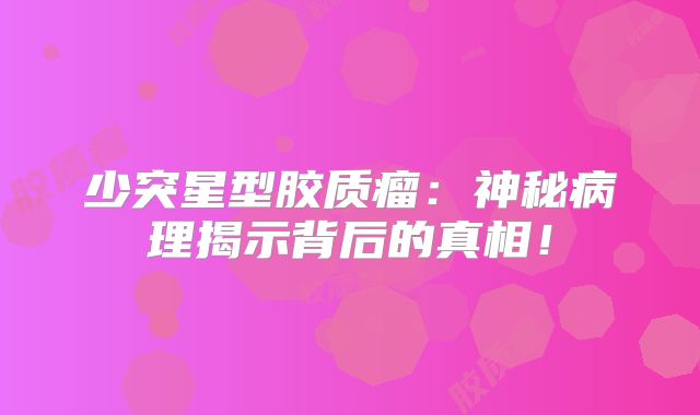 少突星型胶质瘤：神秘病理揭示背后的真相！