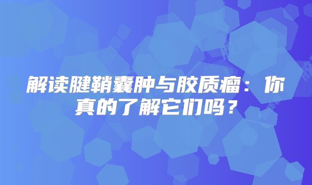 解读腱鞘囊肿与胶质瘤：你真的了解它们吗？