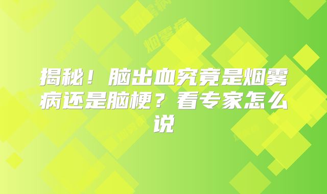 揭秘！脑出血究竟是烟雾病还是脑梗？看专家怎么说