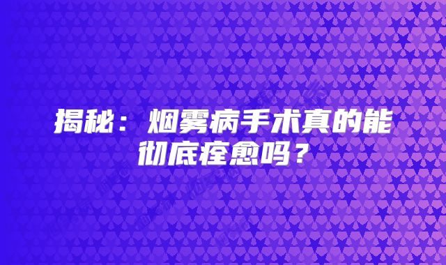 揭秘：烟雾病手术真的能彻底痊愈吗？