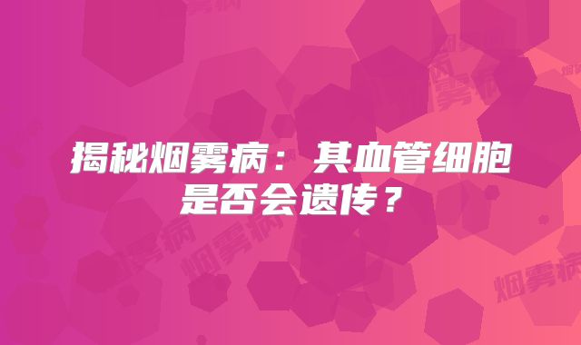 揭秘烟雾病：其血管细胞是否会遗传？