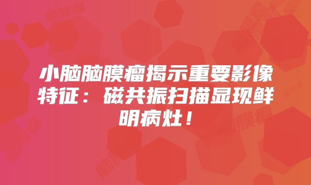 小脑脑膜瘤揭示重要影像特征：磁共振扫描显现鲜明病灶！