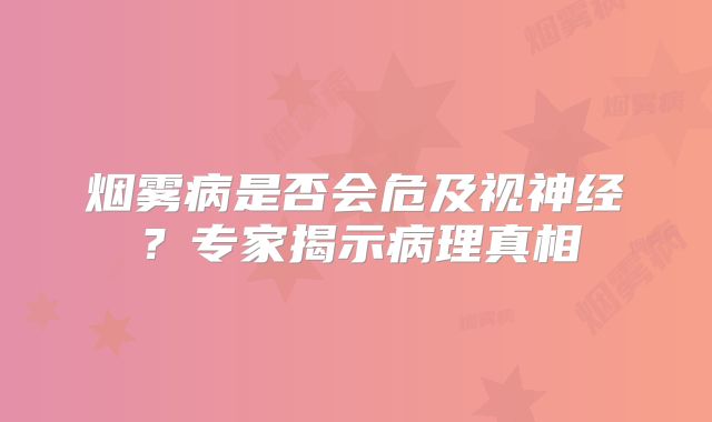 烟雾病是否会危及视神经？专家揭示病理真相