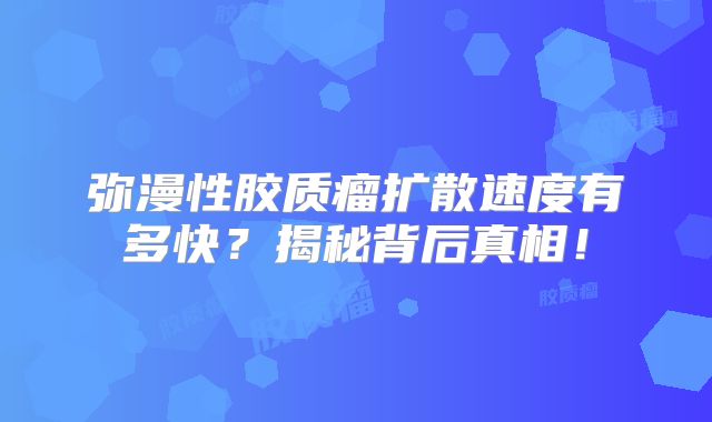 弥漫性胶质瘤扩散速度有多快？揭秘背后真相！