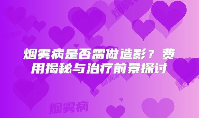 烟雾病是否需做造影？费用揭秘与治疗前景探讨