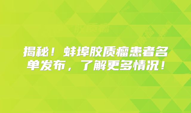 揭秘！蚌埠胶质瘤患者名单发布，了解更多情况！